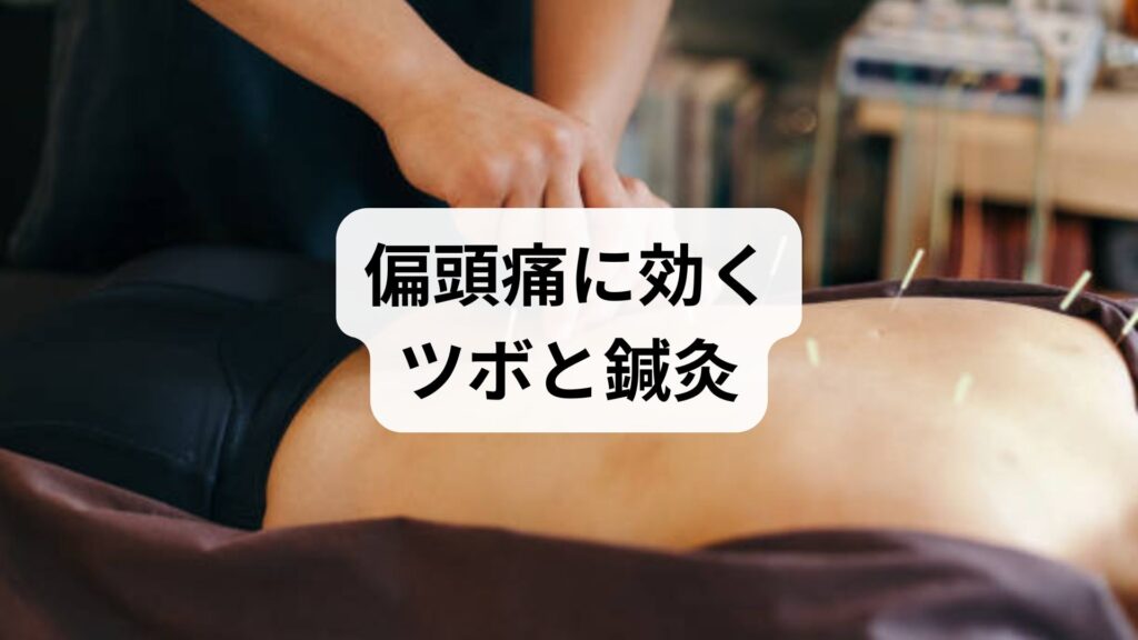 偏頭痛に効くツボと鍼灸｜薬が効かない人のための実践ガイド