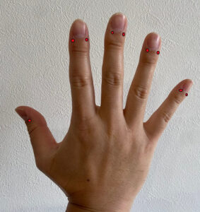 急な便秘や腹痛に効果的な、指先の「井穴(せいけつ)」とお腹の「天枢(てんすう)」を紹介します。
井穴は、爪の両端にある生え際から約2mm下に位置します。全ての指を一本ずつ摘まむように指圧してください。外出先での突然の腹痛など、緊急時の対処法として非常に便利です。また、吐き気対策でも触れた天枢は、腸を直接刺激して溜まったガスを排出させるため、便秘解消にも役立ちます。お腹が張りやすい方は、特にお灸でじんわり温めるとセルフケア効果がさらに高まります。