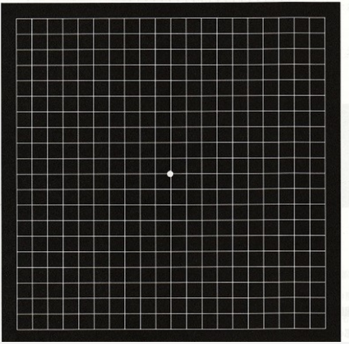 中心性漿液性脈絡網膜症の早期発見には、視野の歪みを調べるチェックが有効です。格子状のシート（アムスラーチャート）を使い、片目ずつ中心の点を見つめてください。線が波打って見える「変視症」や、中心部が暗く欠ける症状は原因不明のストレスや自律神経の乱れが引き金となります。放置は睡眠の質低下を招くため、違和感があれば早めの改善対策が不可欠。健やかな視界を守るため、定期的に確認しましょう。