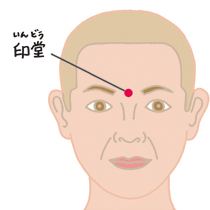 私たちの身体には、健康を整える「ツボ」が数多く点在しています。鍼灸治療ではこれらのツボを専門的に活用しますが、ご自身で刺激するセルフケアも、後鼻漏（こうびろう）の症状改善に非常に効果的です。ここでは、鼻の通りをスムーズにするオススメのツボを2つご紹介します。

①迎香（げいこう）
小鼻のすぐ脇、ほうれい線上に位置するツボです。押し方にコツがあり、眉毛の方へ向かって「斜め45度」の角度で力を加えるのがポイント。3秒間ゆっくり押して離す動作を5回1セットとし、一日に4〜5回行いましょう。

②印堂（いんどう）
左右の眉間の中央にあり、押すと「痛気持ちいい」と感じる部分です。ここは中指の腹を使い、円を描くように優しくマッサージします。時計回りに10回、反時計回りに10回を3セット。こちらも一日4〜5回を目安に継続することで、鼻の奥の不快感や喉への流れを和らげます。