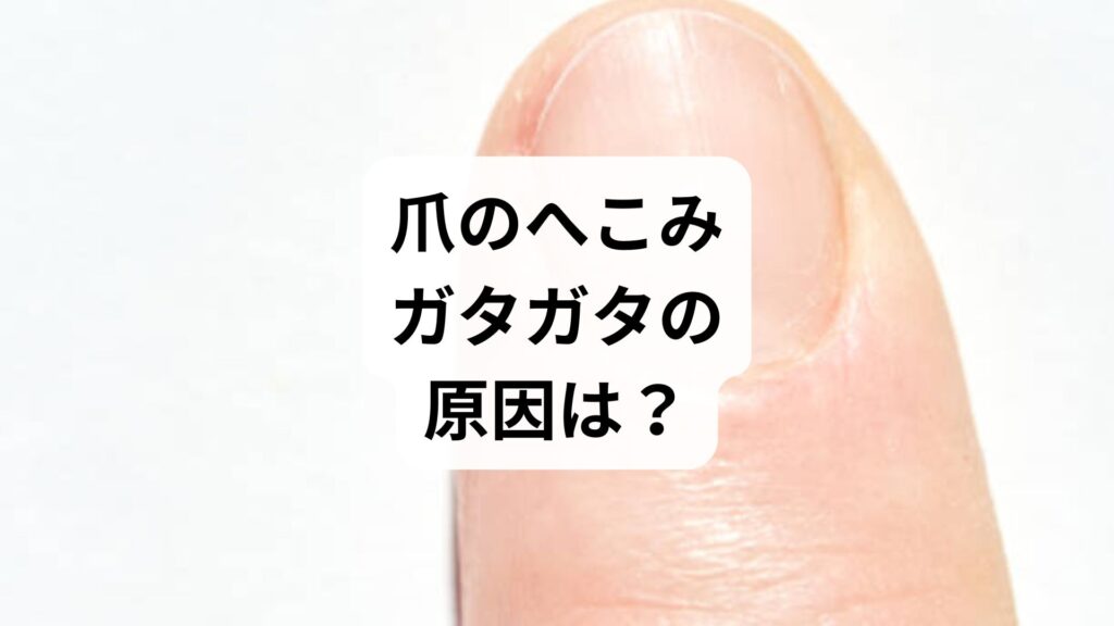 爪のへこみ・ガタガタの原因は？ストレスや栄養不足、病気のサインと改善策を解説