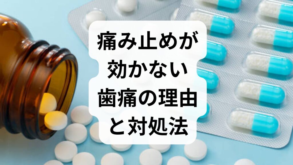 痛み止めが効かない歯痛の理由と対処法｜ロキソニンが効かない原因