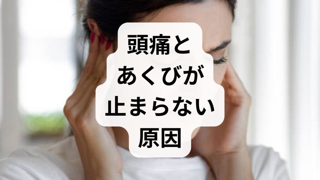 【専門家監修】頭痛とあくびが止まらない原因は脳の酸欠？生あくびから片頭痛が起こるメカニズムと即効対処法