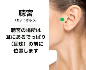 耳管開放症のセルフケアとして、最も効果的とされるツボが「聴宮（ちょうきゅう）」です。

聴宮（ちょうきゅう）の位置
・耳の前にある、小さな三角形の突起（耳珠：じじゅ）のすぐ前にあります。
・口を少し開けたときに、指がすっぽりと入るようなくぼみができる部分です。

ツボマッサージの具体的なやり方
1. 人差し指か親指の腹を「聴宮」のくぼみにあてます。
2. 口の力を抜き、少しリラックスした状態で、痛気持ちいいと感じる強さで優しく圧迫します。
3. 5秒間じわーっと押し、5秒離す。これを3〜5回繰り返します。
4. 周辺の筋肉をほぐすように、円を描きながら優しくマッサージするのも効果的です。

※ツボマッサージを行う際は、強く押しすぎないように注意してください。また、耳の痛みや炎症がある場合は無理に行わず、早めに専門医へ相談してください。