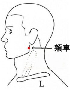 「病院に行くまでの間、少しでもこの痛みをマイルドにしたい」「仕事や家事に集中できない」というときにおすすめの、即効性が期待できる効果的なツボをご紹介します。

① 翳風（えいふう）
・場所： 耳たぶの後ろにある、乳様突起（出っ張った骨）のすぐ前にある窪みです。
・効果： 耳の周りの痛み、腫れ、頭痛、肩こりの緩和、さらには顔面麻痺やくすみのケアにも用いられます。
・押し方： 人差し指や親指の腹を使い、優しく、ゆっくり3〜5秒かけてじんわりと押し、ゆっくり離します。これを3〜5回繰り返してください。
※強く押しすぎないよう注意しましょう。

② 頬車（きょうしゃ）
・場所： 顎の角（エラ）から指1本分上のあたりで、奥歯をギッと噛み締めたときに筋肉がぷくっと盛り上がる場所にあります。
・効果： 歯の痛み、顎関節症の痛み、ストレスによる食いしばりの緩和、顔のむくみ解消に効果的です。
・押し方： 人差し指や中指で、心地よいと感じる強さで円を描くように優しくマッサージするように押します。